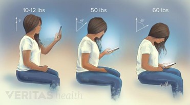 Correct Headposture for devices